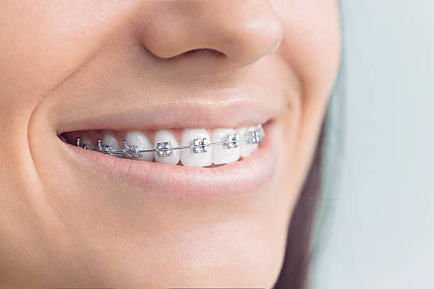 Best Traditional Braces  in Seffner, FL